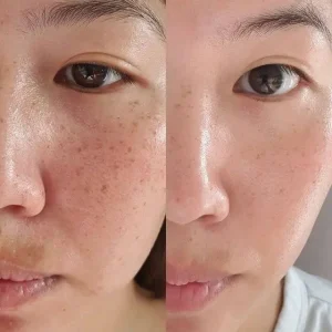 کرم دور چشم کلینیک اسمارت کلینیکال ریپیر | Clinique Smart Clinical Repair Wrinkle Correcting Eye Cream)